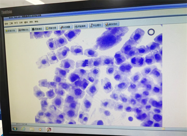 有丝分裂 分裂像.png 有丝分裂 分裂像.png